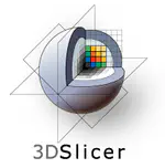 3D Slicer