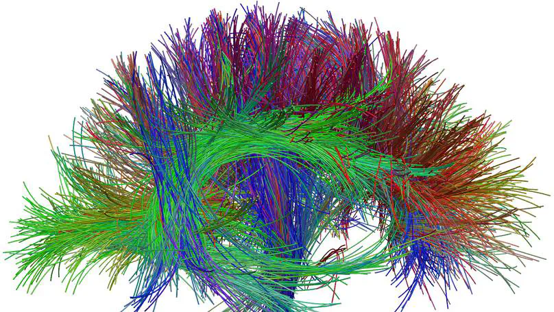 Diffusion MRI Q-ball CSA-ODF and Hough Tractography