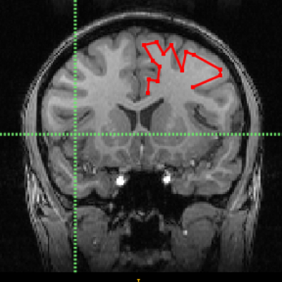 Greedy | Open Neuroscience