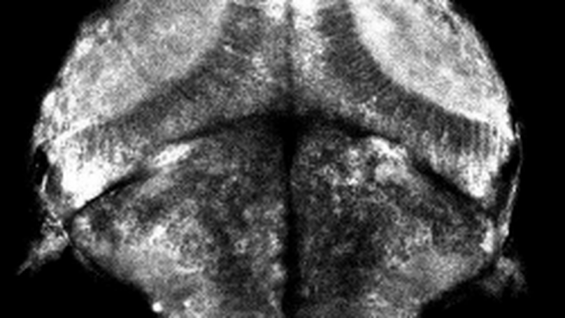 Non-Telecentric 2P microscopy for 3D random access mesoscale imaging (nTCscope)